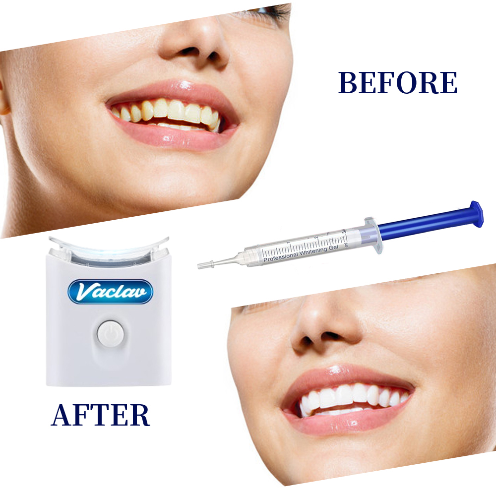 Jeringa de Gel blanqueador de  - Teeth Whitening Gel Syringes reseña y precio