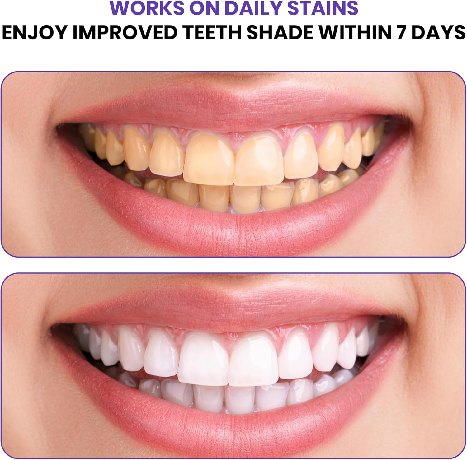 Tiras Blanqueadoras de Dientes - Teeth Whitening In Office reseña y precio