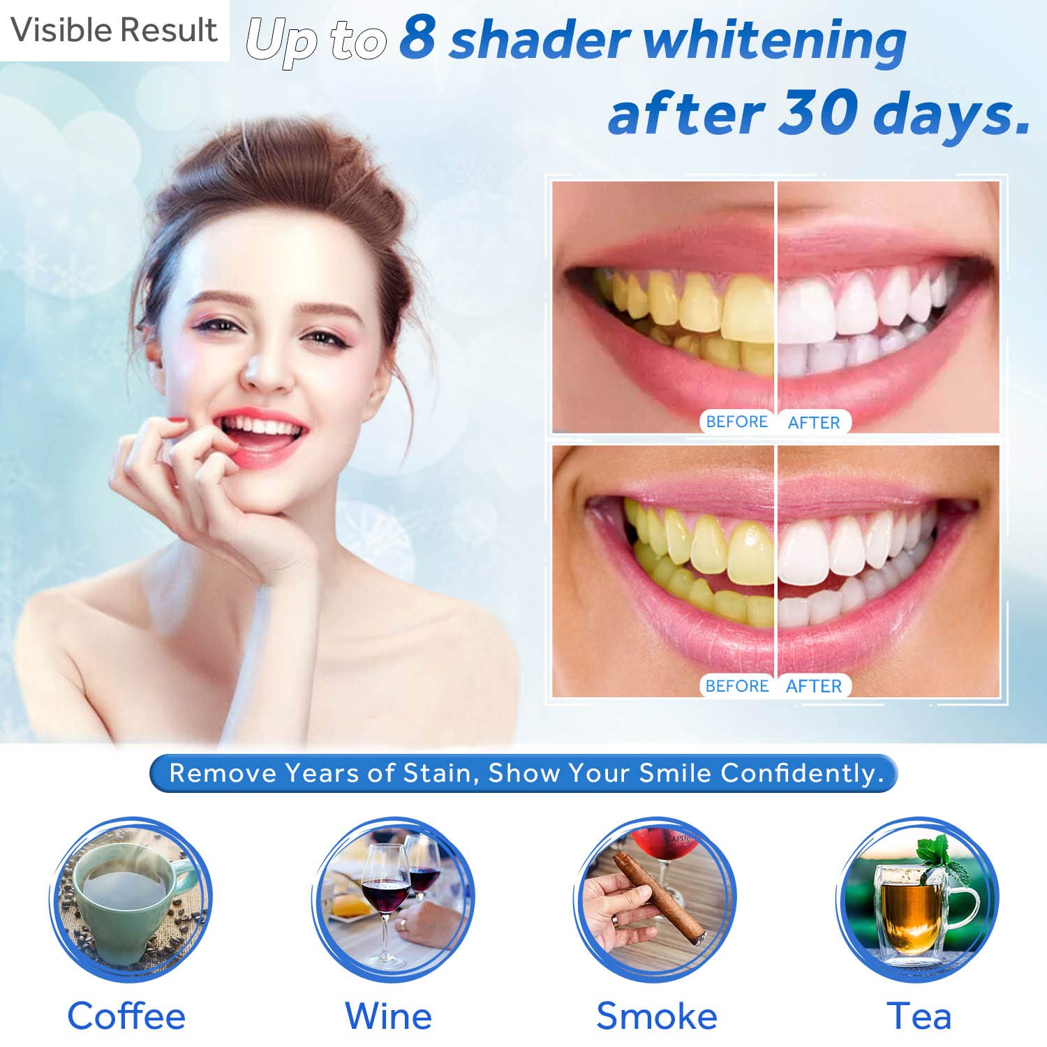 Jeringa de repuesto de Gel par - Teeth Whitening Gel Syringes reseña y precio