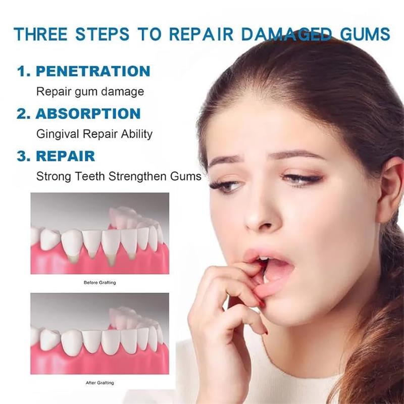 Suero Reparador de Encías, Ali - Teeth Whitening Gingival Barrier reseña y precio