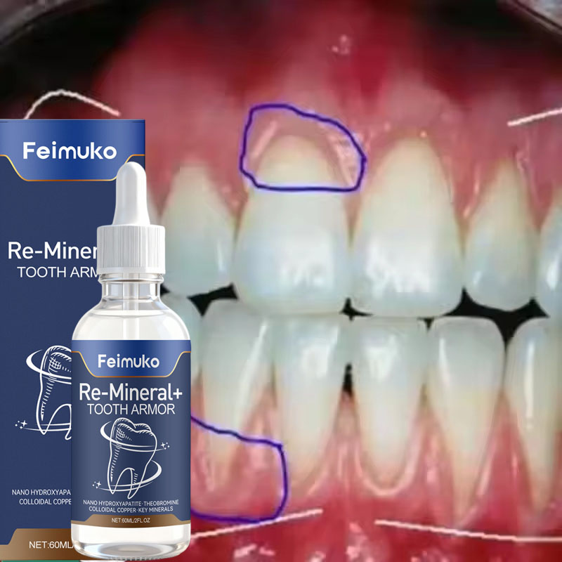 Suero Reparador de Encías, Ali - Teeth Whitening Gingival Barrier reseña y precio