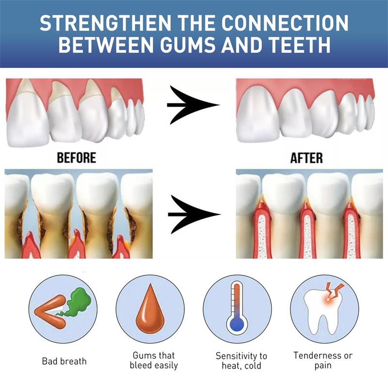 Suero Reparador de Encías, Ali - Teeth Whitening Gingival Barrier reseña y precio