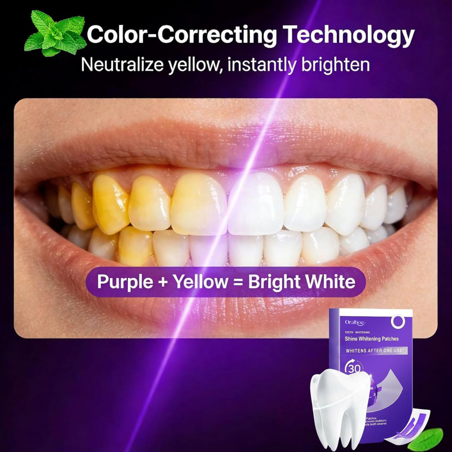 Kit Combinado para Blanqueamie - Teeth Whitening In Office reseña y precio