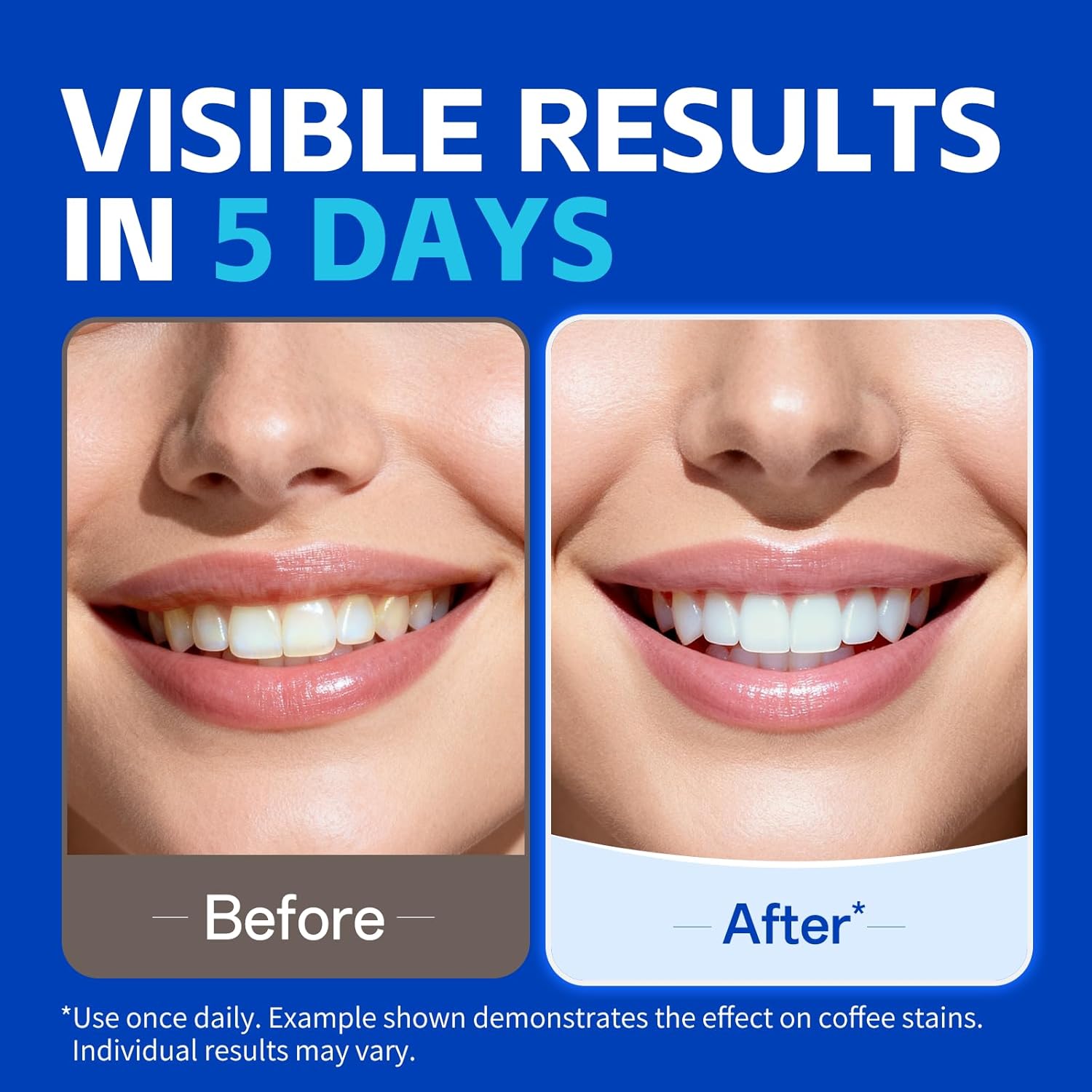 1/7 pares de tiras blanqueador - Teeth Whitening Strips Permanent reseña y precio