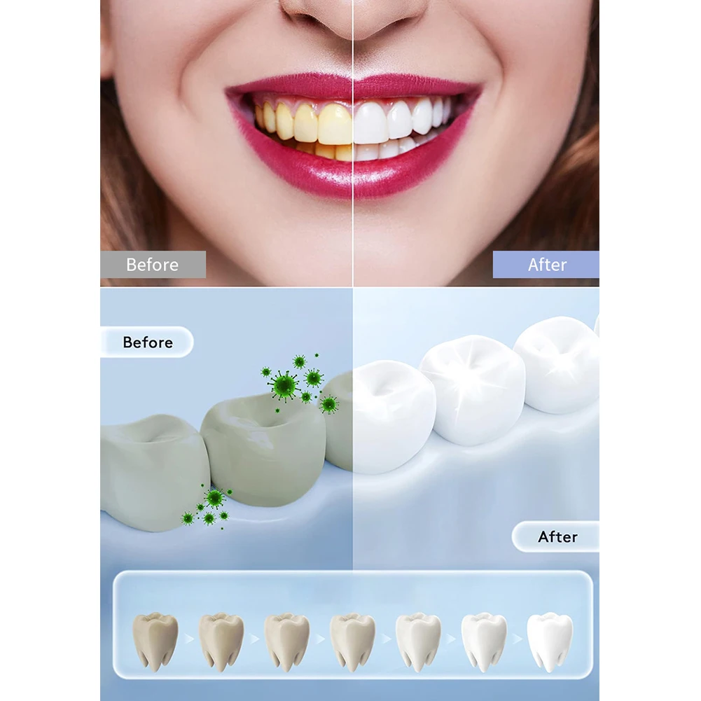 Lámpara LED inteligente para b - Teeth Whitening In Office reseña y precio