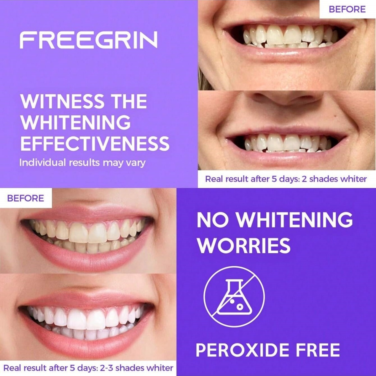 Pegatinas blanqueadoras de die - Teeth Whitening In Office reseña y precio