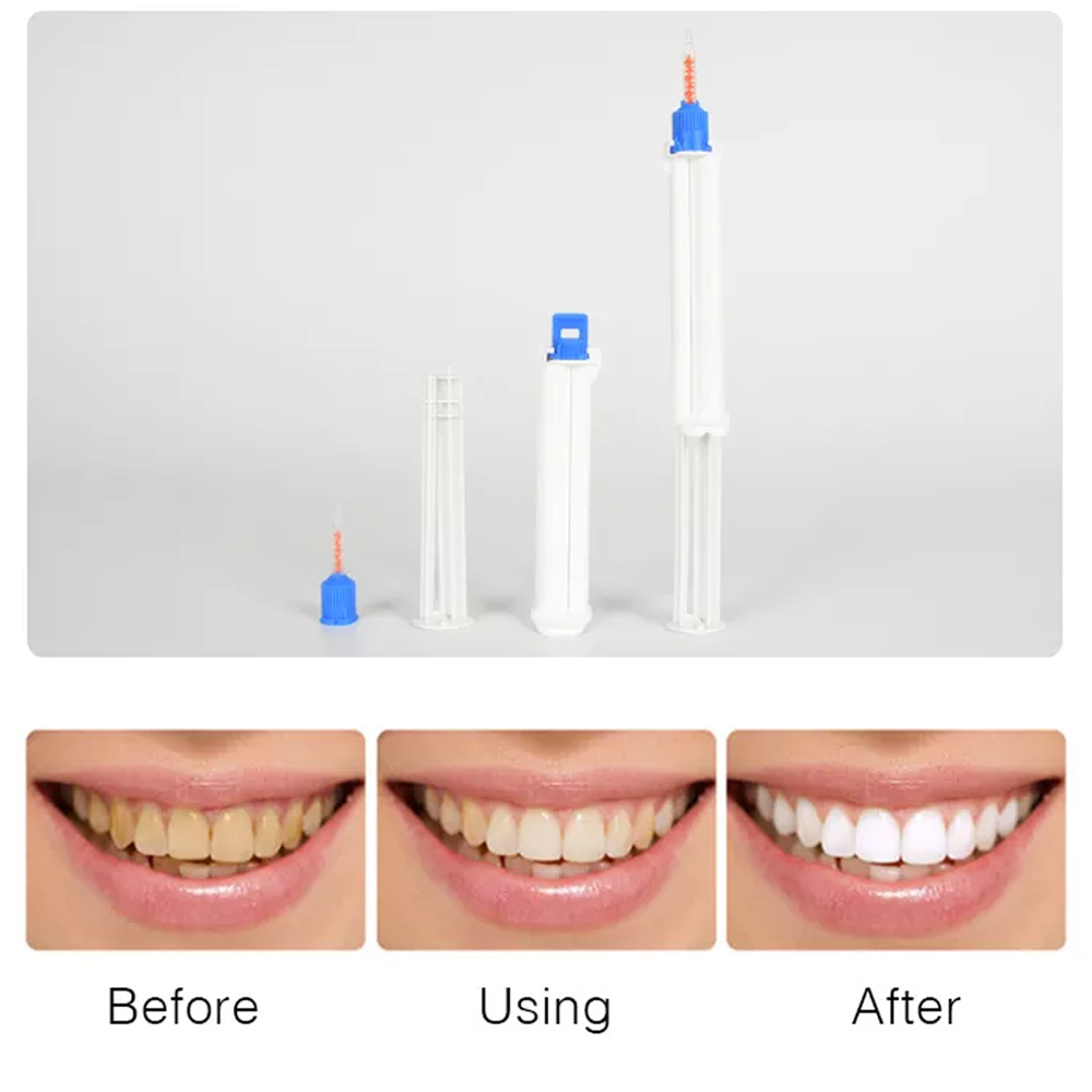 Jeringa Dental de doble barril - Teeth Whitening Gingival Barrier reseña y precio