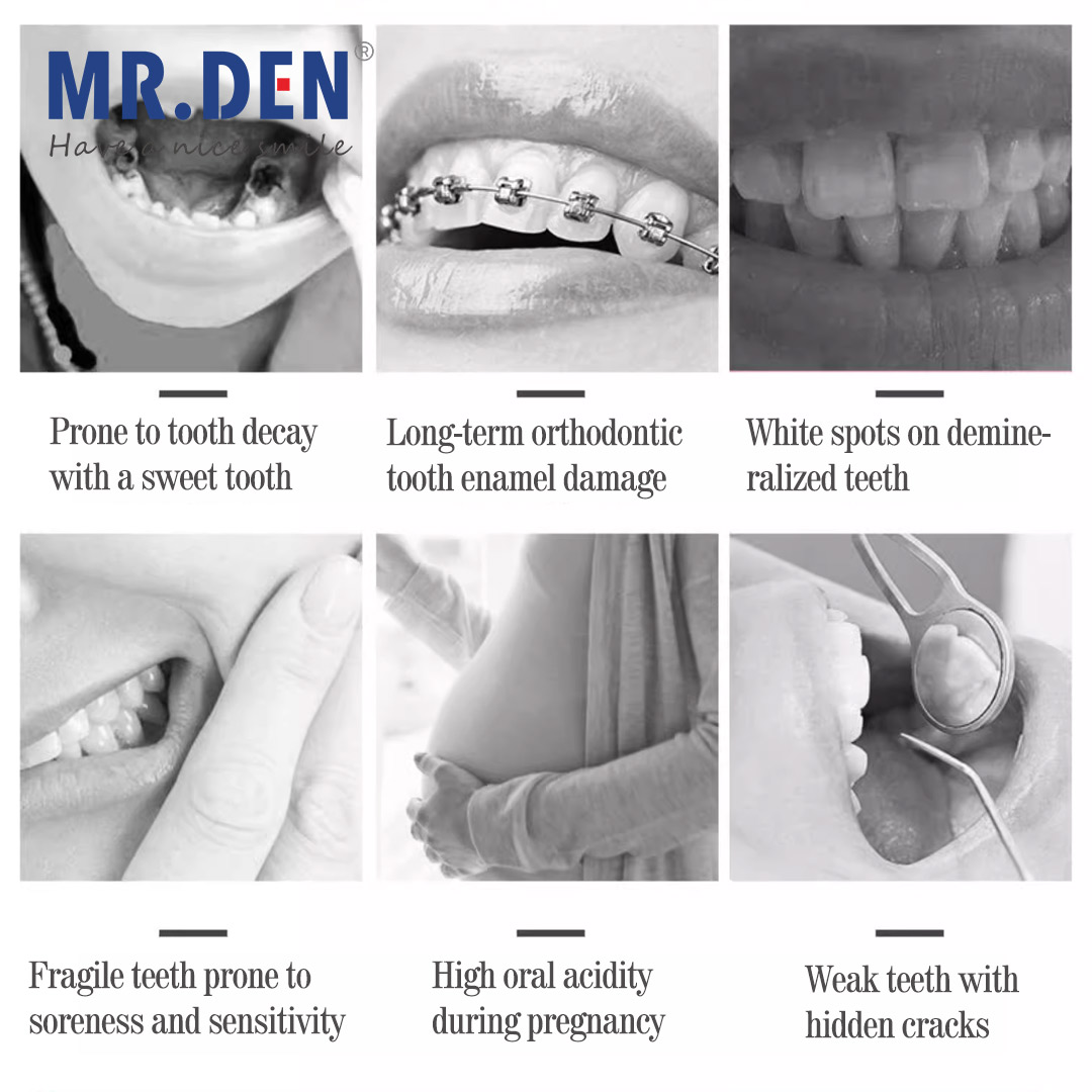 Cuidado Dental mejorado de flu - Teeth Whitening In Japan reseña y precio