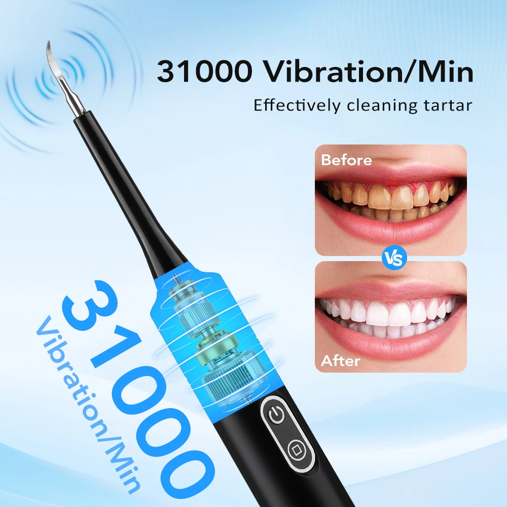Limpiador Dental Eléctrico con - Teeth Whitening Uk reseña y precio